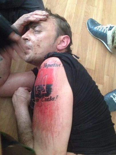 «Ариец» укро-нацист 02.02.15. Фото от ополчения.

«Перед взятием в плен укр пытался кирпичом оттереть татуировку, чтобы слишком не палиться (так как фашики знают, что к ним совсем другое отношение, нежели к срочникам ВСУ), но печать нацизма не так уж просто оттереть, УНА УНСО ОУН смердячие псы собаки Гитлера, ac19411941, Одинцово